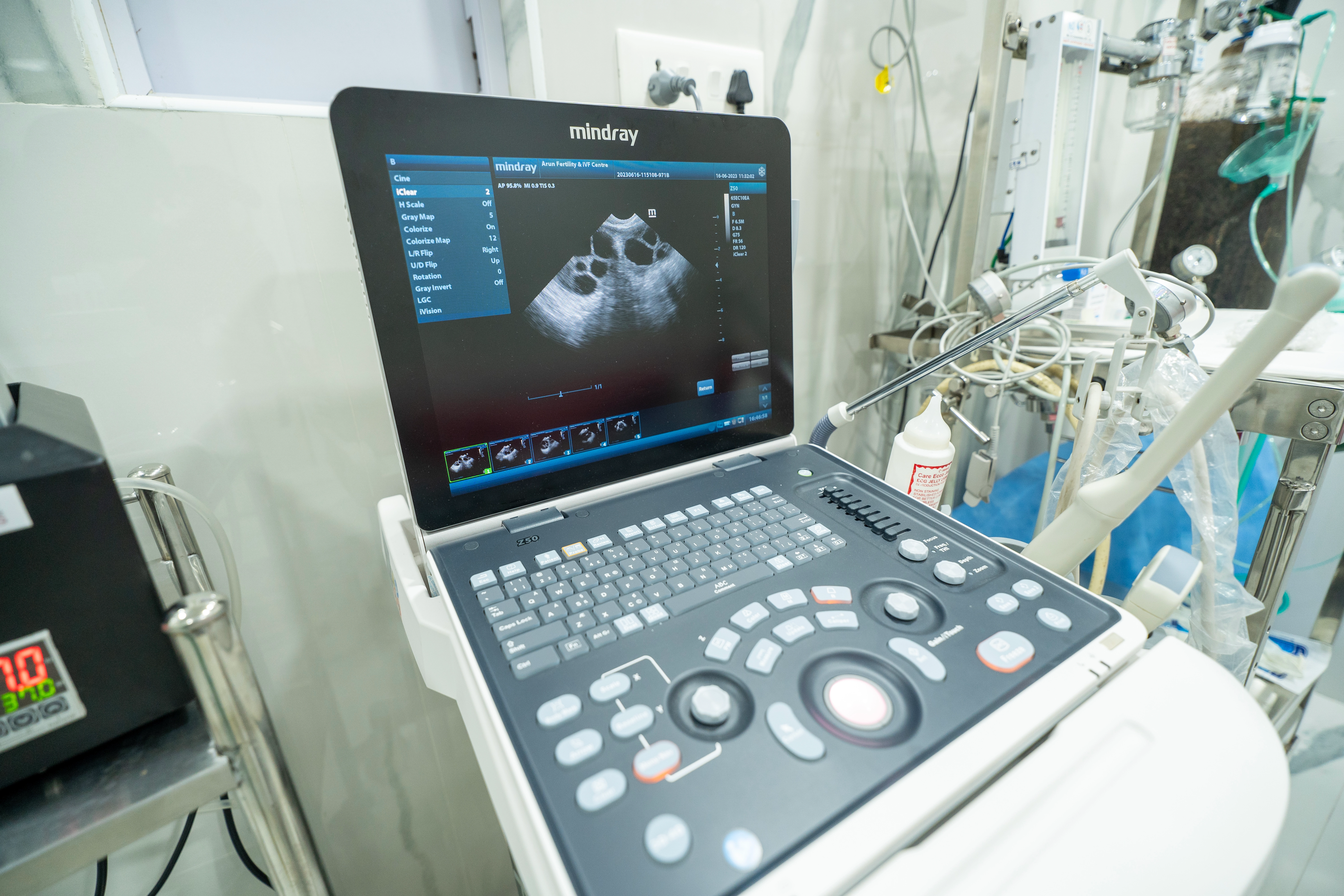 Best infertilty apparatus at Andaman Fertility and IVF Andaman